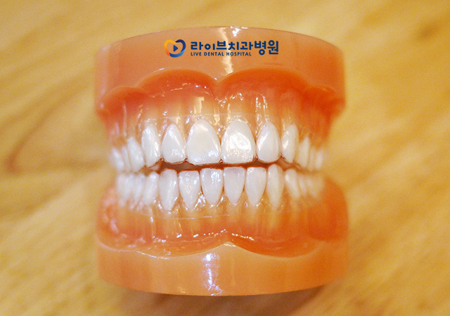 투명교정비용, 저렴한 곳보다는 전문적인 곳에서! 관련 이미지 3