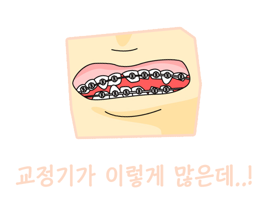 교정기의 종류에 대해 알아보자! 관련 이미지 1