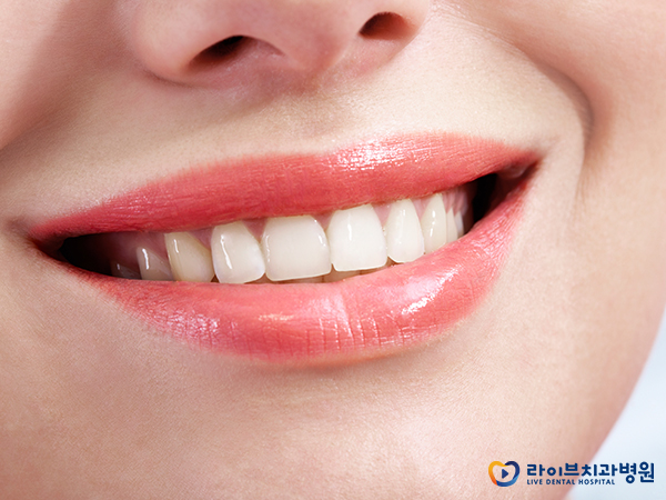 돌출입교정, 증상에 맞는 치료가 필요해요 관련 이미지 5