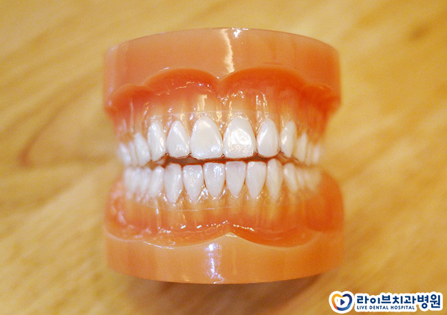 투명교정 가격 합리적인 곳 찾는다면! 관련 이미지 3