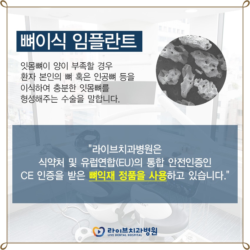 임플란트 뼈이식 어떤 경우 받아야 할까? 관련 이미지 4