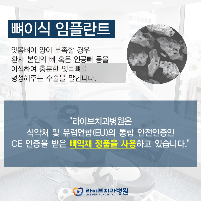 전체임플란트 꼼꼼하게 알아보고 분납까지! 관련 이미지 3