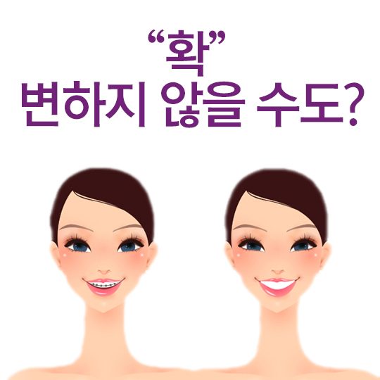 치아교정 얼굴변화, 변화의 정도는? 관련 이미지 3