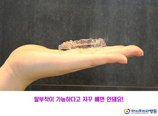 투명교정, 자체 제작으로 만족도 UP! 관련 이미지 6