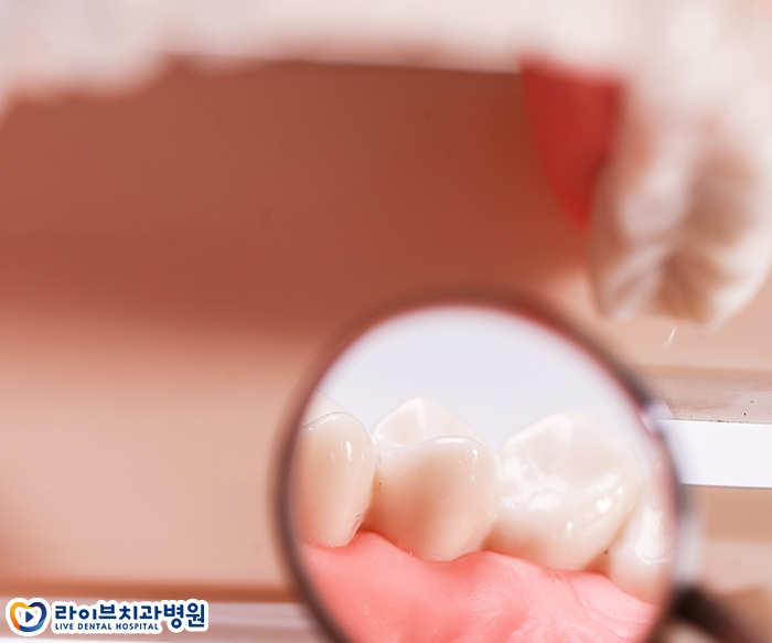 어금니 잇몸 부음 왜그런걸까요? 관련 이미지 2