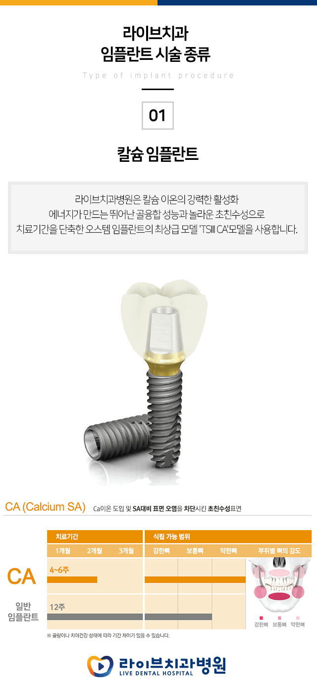 임플란트 가격 저렴한 곳 알고 계시나요??? 관련 이미지 3