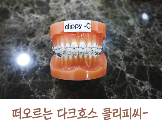 교정기의 종류에 대해 알아보자! 관련 이미지 5