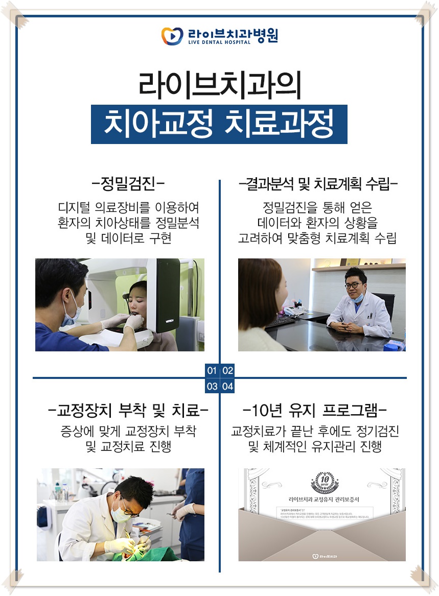 치아교정종류 상황에 맞게! 관련 이미지 11