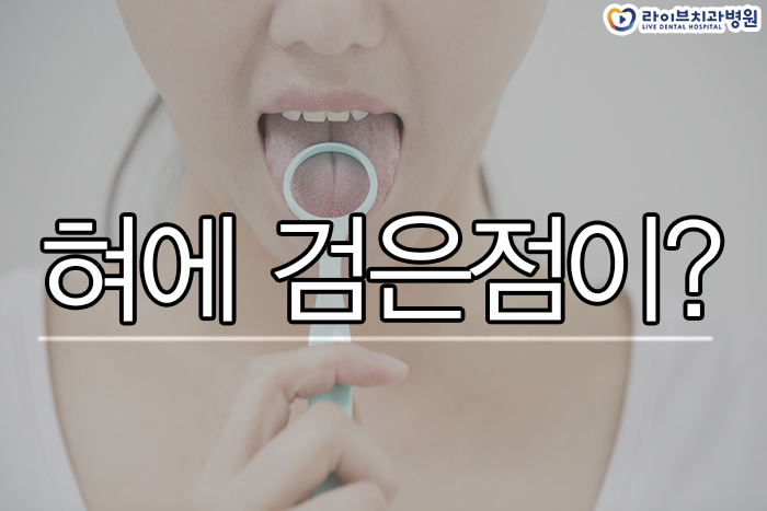 혀에 검은점이 났다면? 관련 이미지 1