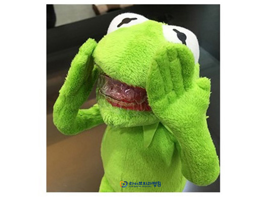 투명교정, 자체 제작으로 만족도 UP! 관련 이미지 2