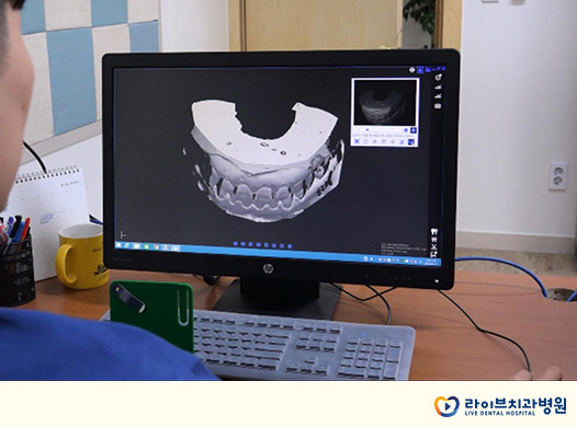 투명교정비용, 합리적으로 찾는 미소 관련 이미지 7