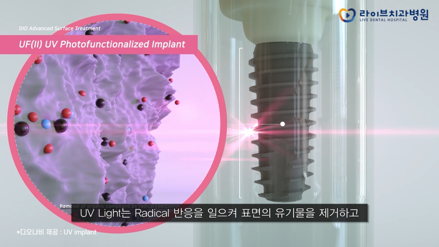 성공률은 높이고 부작용은 낮추는 관련 이미지 2