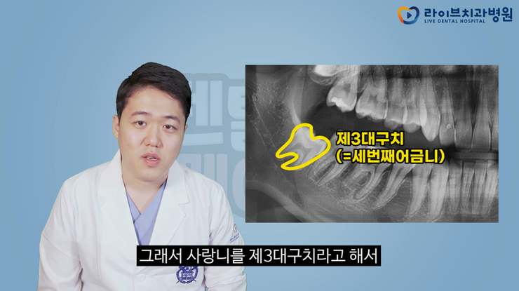 매복사랑니 꼭 뽑아야 하나요? | 덴탈메이트 관련 이미지 2