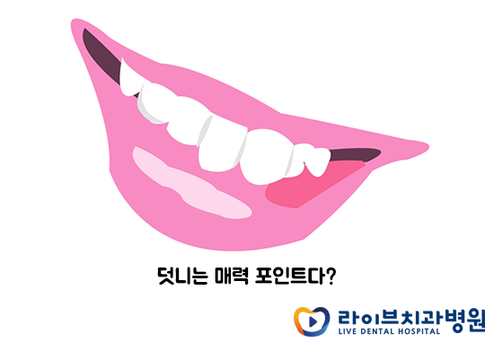 치아의 건강과 미소를 되찾기 위한 덧니교정 관련 이미지 4