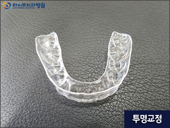 치아교정장치 차이점을 비교해보자 관련 이미지 5