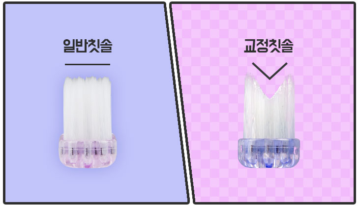 치아교정관리, 양치법부터 바로 알자! 관련 이미지 2