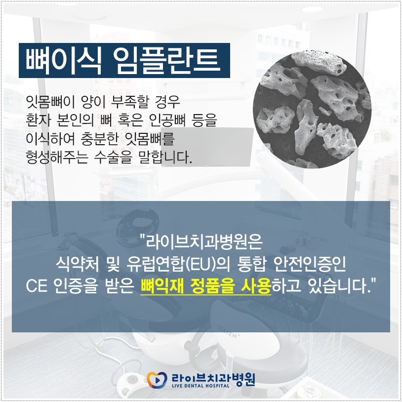 신논현역치과, 발치 즉시 임플란트 하려면? 관련 이미지 5