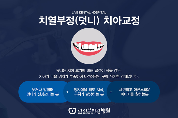 개포동 치아교정 받아보기 전 관련 이미지 2