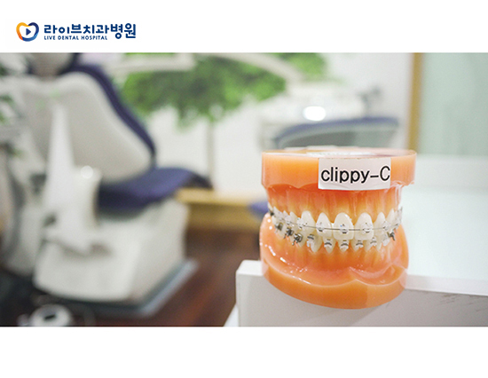 클리피씨교정, 정말 치료기간 단축이 가능할까? 관련 이미지 3