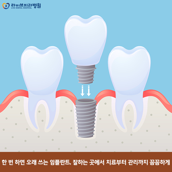 임플란트잘하는곳 꼼꼼하게 체크해보자! 관련 이미지 3