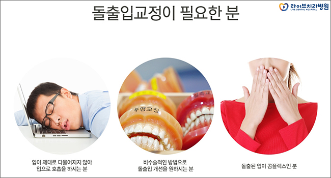 돌출입교정 올바른 치료계획을 세우자 관련 이미지 5