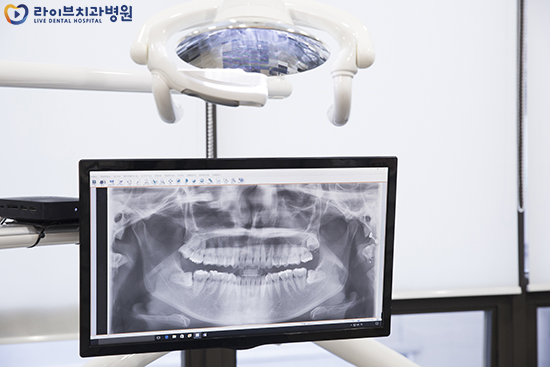 어금니임플란트 가격 찾아보고 있다면 관련 이미지 4