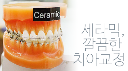 깨끗한 느낌을 주는 세라믹교정:) 관련 이미지 4