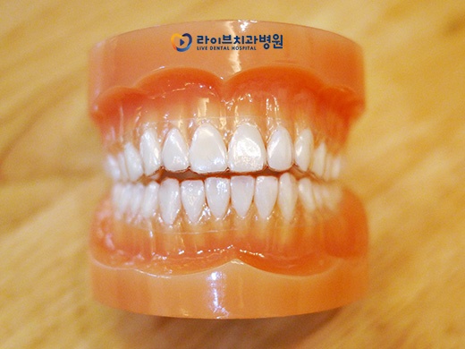 투명교정 대상과 장점은? 관련 이미지 4