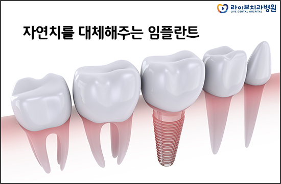 임플란트 뼈이식 꼭 해야되는 걸까요? 관련 이미지 2