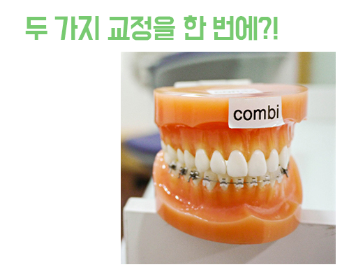 콤비교정, 두 가지 교정을 한다? 관련 이미지 4