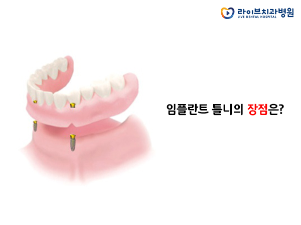 임플란트틀니, 무엇이 어떻게 좋을까요? 관련 이미지 2