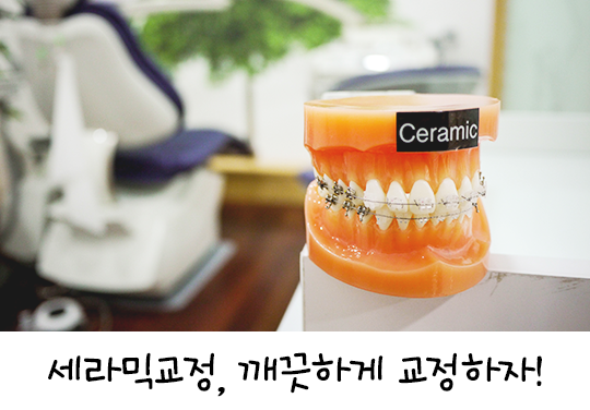 세라믹교정으로 깔끔하게 교정해요! 관련 이미지 1