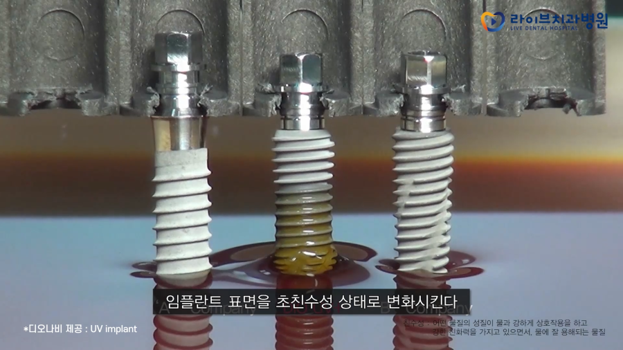 성공률은 높이고 부작용은 낮추는 관련 이미지 3