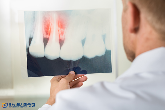 치통 심할 때 어떻게 해야하죠 관련 이미지 4