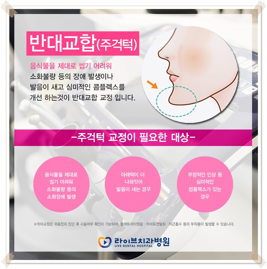 치아교정종류 상황에 맞게! 관련 이미지 3