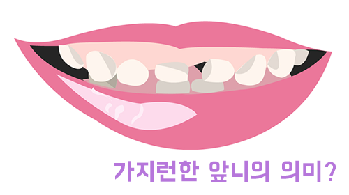 앞니교정, 스트레스 해결할 수 있다! 관련 이미지 2