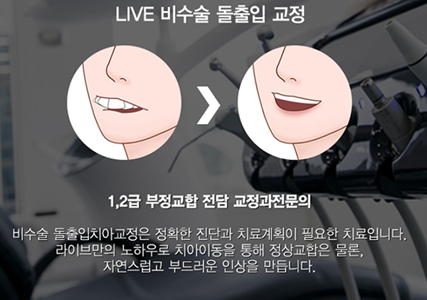 돌출입치아교정 고민이 많으시다면 관련 이미지 4