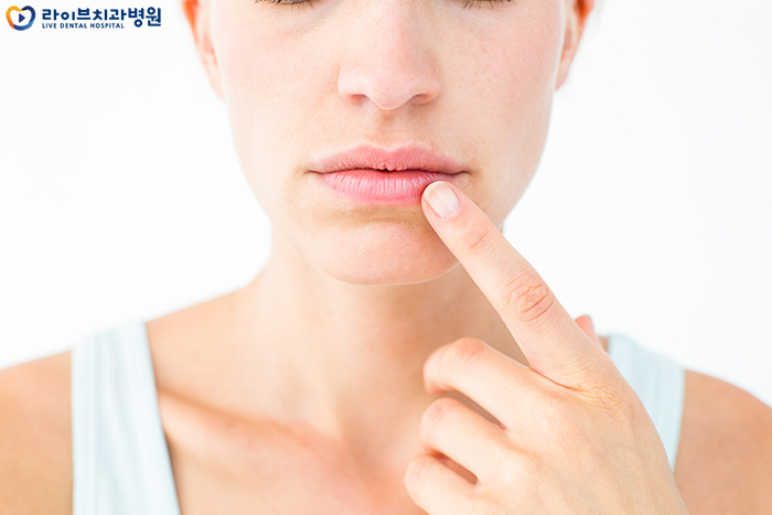 입술 갈라짐 원인이 뭘까? 관련 이미지 4