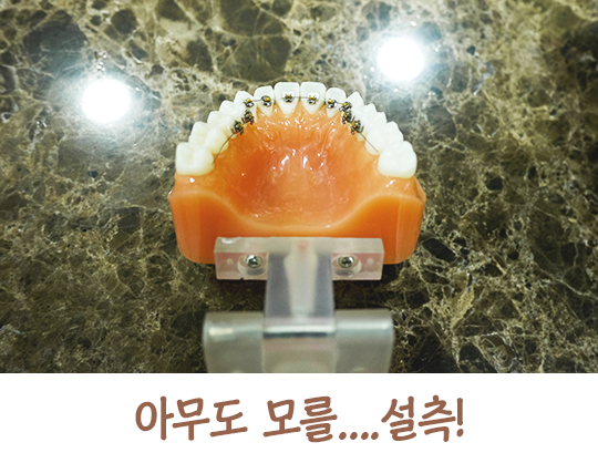 교정기의 종류에 대해 알아보자! 관련 이미지 6