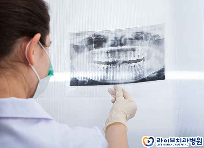 치아교정시기 꼭 정해져 있나요? 관련 이미지 4