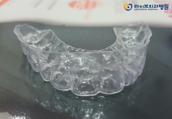 투명교정비용, 비용만 따진다고 될까? 관련 이미지 3