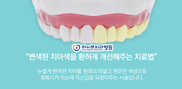 치아미백원리 어떻게 되는건가요? 관련 이미지 2