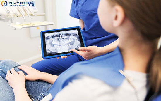 임플란트종류 차이점에 대해서 알아보자 관련 이미지 4