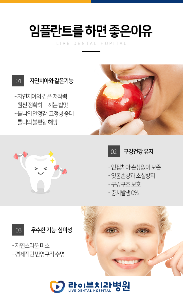임플란트 가격 저렴한 곳 알고 계시나요??? 관련 이미지 1