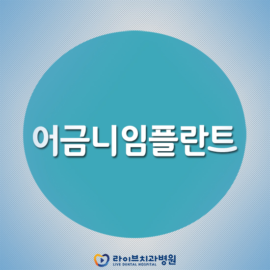 어금니임플란트 심미성과 기능을 한 번에! 관련 이미지 1
