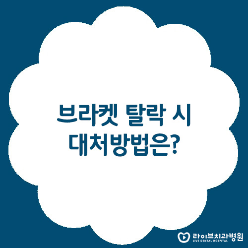치아교정(: 브라켓 탈락 시 대처방법은? 관련 이미지 1