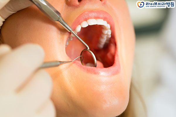 임플란트가격 요점을 파악하자 관련 이미지 6