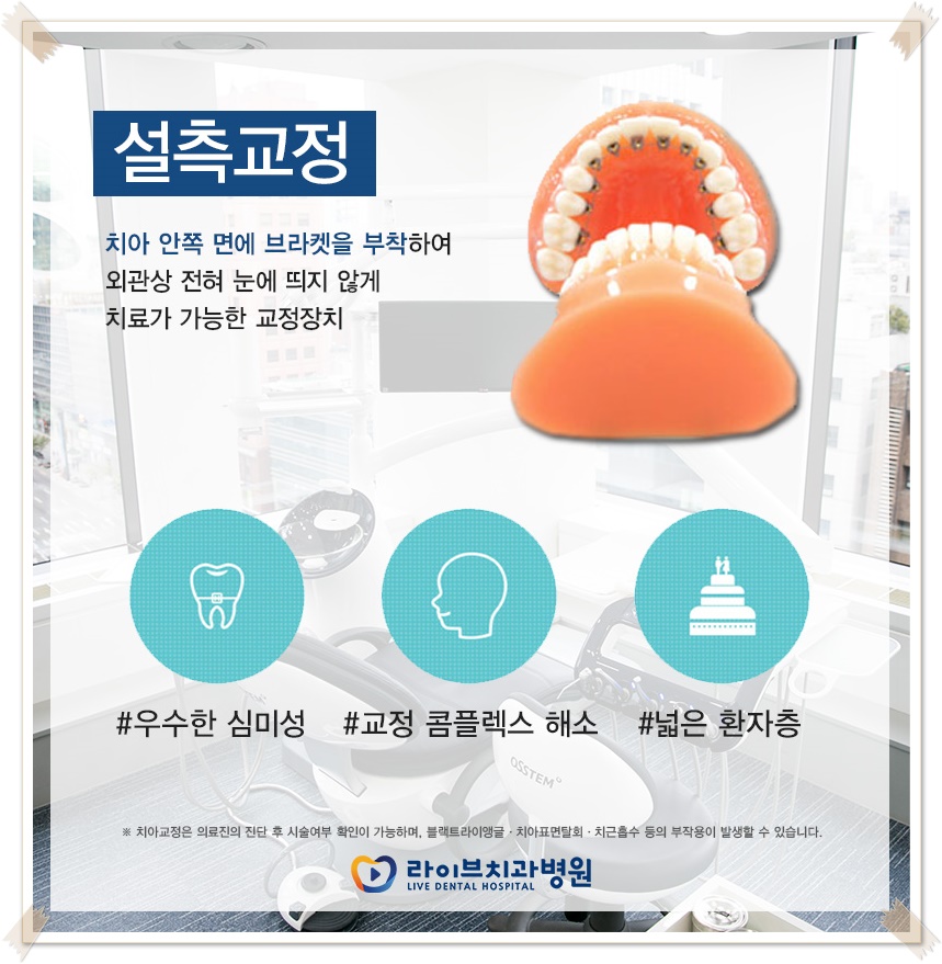 치아교정종류 상황에 맞게! 관련 이미지 9