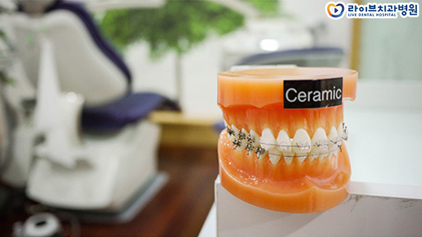 세라믹교정 어떤 점이 좋을까요? 관련 이미지 2