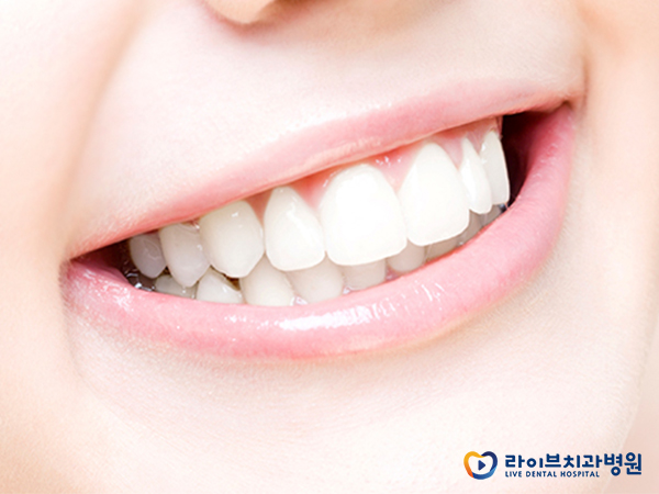 앞니교정 잘하는 강남역치과 어디? 관련 이미지 2